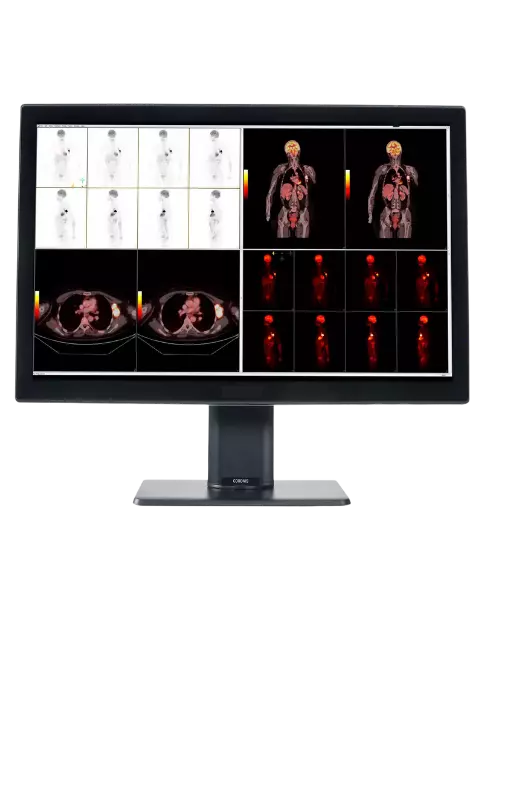 Monitores grado médico