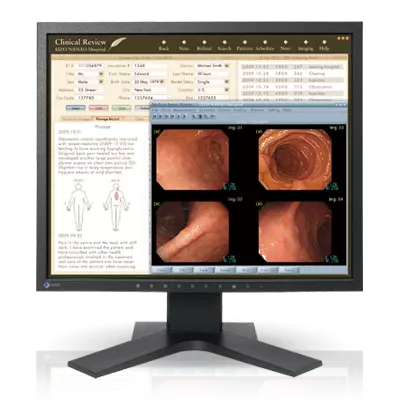 RadiForce-MX191
