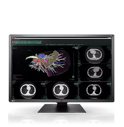 RadiForce-RX660