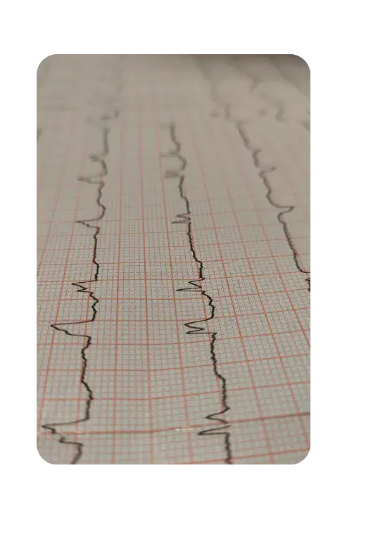 Telecardiología