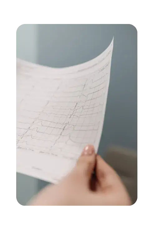 Interpretación ECG