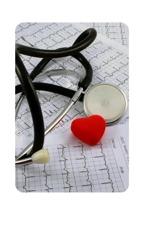 Electrocardiogramas